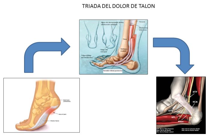 triada-dolor-talon-esquema-evolutivo